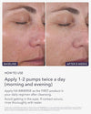 Before and after skin results from using Alastin HA Immerse Serum