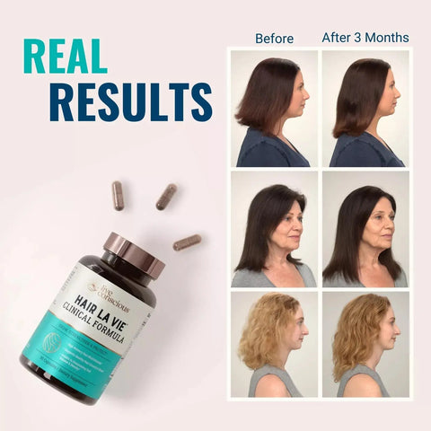 Real Results After 3 months with Clinical Formula Hair Vitamins by Hair La Vie for thicker hair.