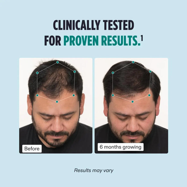 Nutrafol Cilinically tested