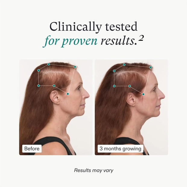 nutrafol women clinically tested