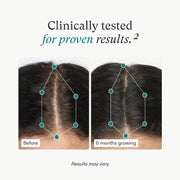 Enjoy less hair shedding & scalp fullness using Clinically tested Nutrafol Hair Vitamins for Women.