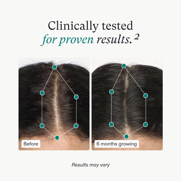 Enjoy less hair shedding & scalp fullness using Clinically tested Nutrafol Hair Vitamins for Women.