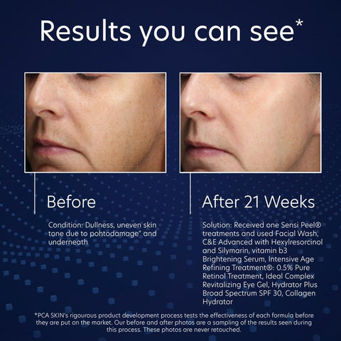 Before and after comparison of skin treatment results with text on a blue background
