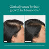Before and after comparison of hair growth on woman using Nutrafol Women's Hair Growth Vitamins dietary supplement, showing thicker, fuller hair.
